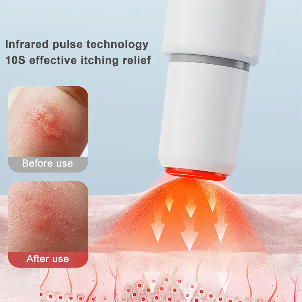 Portable Mosquito Insect Bite Relieve Itching Pen Natural Electric Insect Bite Healer Anti-Itch Pen for Camping Travel Outdoor